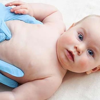 Çocuklarda İnek Sütü Alerjisi